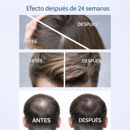 Recupera densidad capilar en solo 15 minutos al día