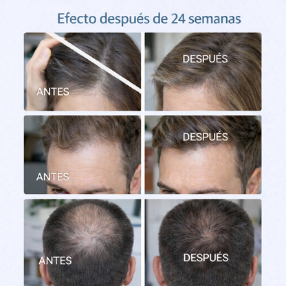 Recupera densidad capilar en solo 15 minutos al día